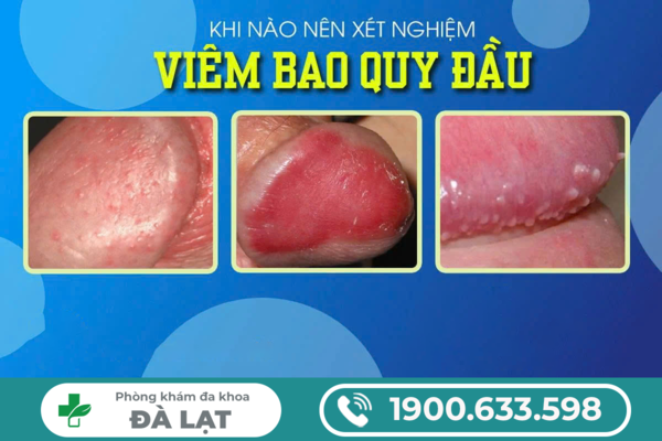 Hình ảnh minh họa